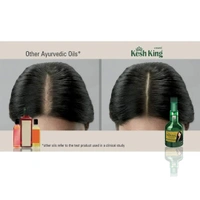 KESH KING OIL (केश किंग तेल) - 100ML