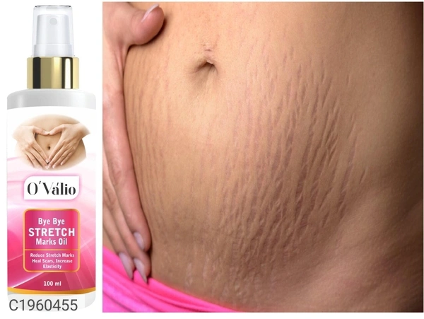 Ovalio Stretch Mark Oil For Mens And Womens Pack Of 1 (100ml)