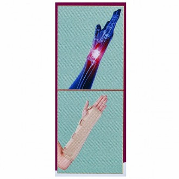 Flamingo Extended Forearm Brace Left - M
