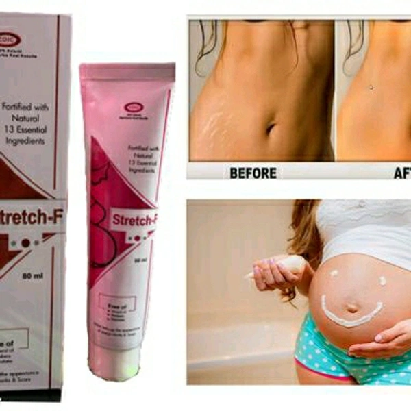 Fancy Stretch Marks Cream & Oil