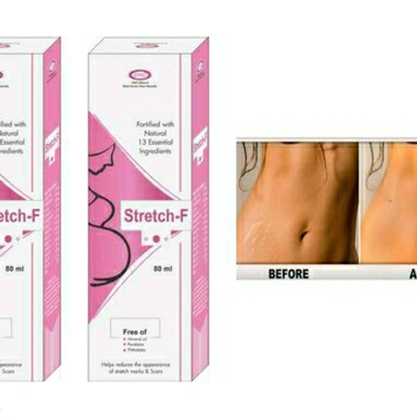 Fancy Stretch Marks Cream & Oil