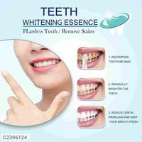High Demand Teeth Whitening Essence,Intensive Stain Removal Teeth Reduce Yellowing Pack of 1*Details:*Product Name -&nbsp;Teeth Whitening Essence,Intensive Stain Removal Teeth Reduce Yellowing Pack of 1Package Contain -&nbsp;Pack of 1Material -&nbsp;Others Weight -&nbsp; 8*5*10Dimension -&nbsp; 100💥 *FREE Shipping* 💥 *FREE COD* 💥 *FREE Return & 100% Refund* 🚚 *Delivery*: Within