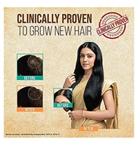 Indulekha Bringha Oil, Reduces Hair Fall And Grows New Hair, 100% Ayurvedic Oil, 100 ml20%off