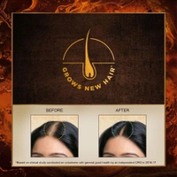 Indulekha  Hair Oil  Indulekha Bringha Hair Oil 50ml 
