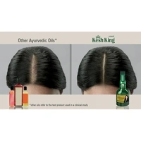 Kesh King Oil  Kesh King Ayurvedic Anti Hairfall Hair Oil, 100ml