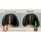 Kesh King Oil  Kesh King Ayurvedic Anti Hairfall Hair Oil, 300ml