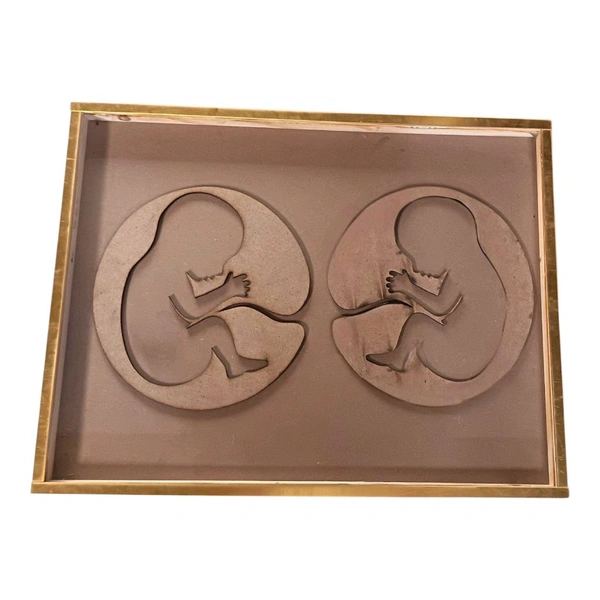Twin Baby Preservation Frame With Golden Border - 16 * 10 * 1 inches