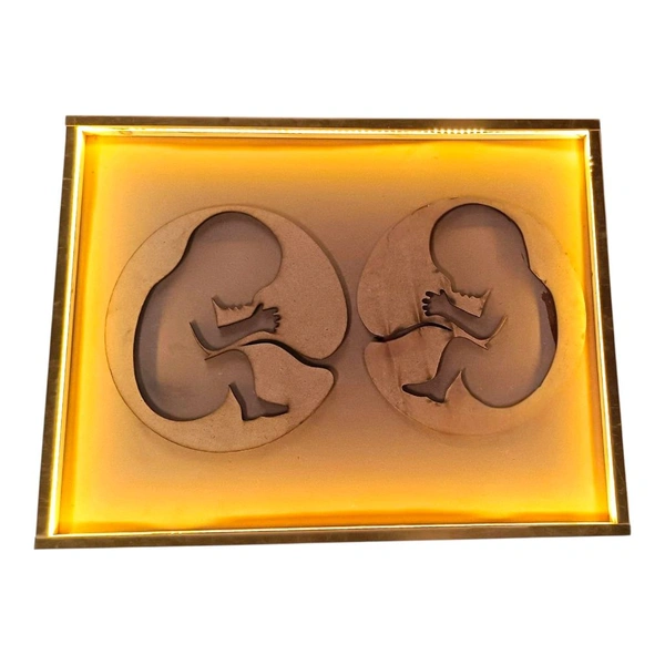 LED Twin Baby Preservation Frame With Gold Border - 16 * 10 * 1 inches