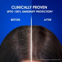 Head & Shoulders Anti Dandruff Shampoo - 340 ML
