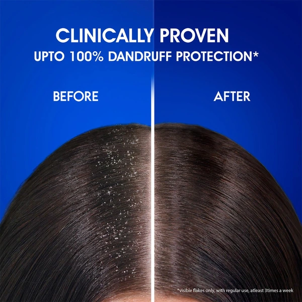 Head & Shoulders Anti Dandruff Shampoo - 340 ML