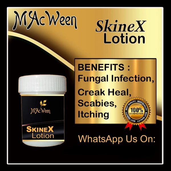 MAcWeen Fungal Infection Lotion 30gm - 30gm, Pink