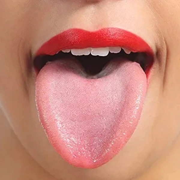 Tongue Cleaner