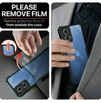 Moto G34 Back Cover 