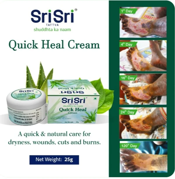 Sri Sri Tattva  Quick Heal Cream - 25gm Pack of 5