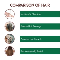 JOVEES HERBAL CARE Anti Dandruff Shampoo - Jovees - 150ml