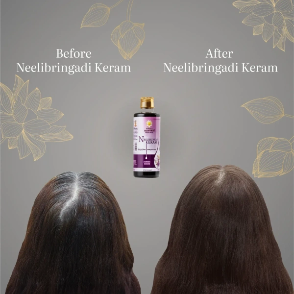 Kerala Ayurveda Neelibringadi Tail 200Ml- Kerala  - 200ml