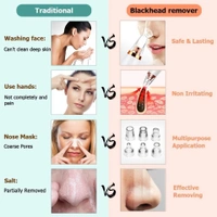 6 in 1 Multi-function Blackhead Remover Tools