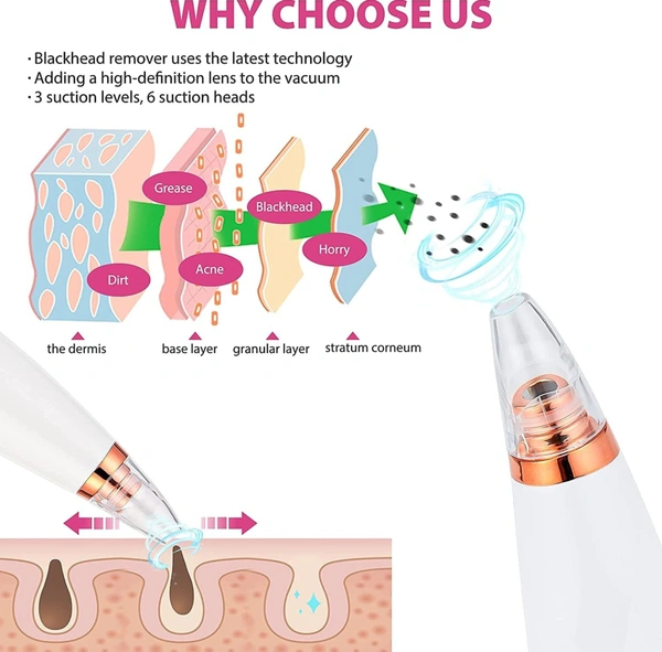6 in 1 Multi-function Blackhead Remover Tools