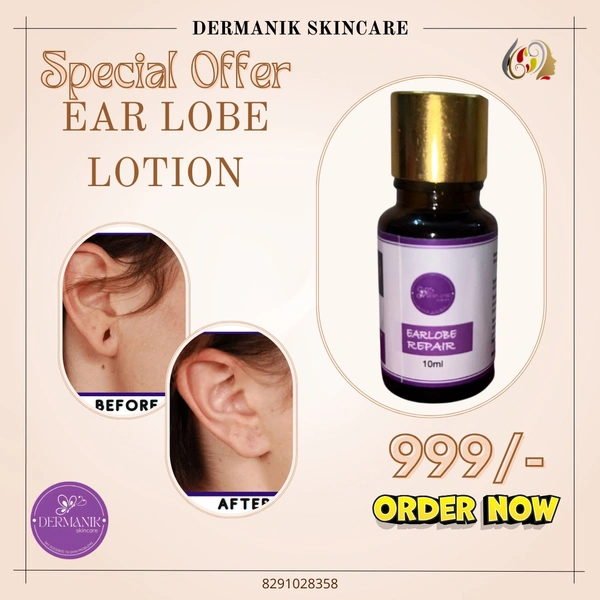 Earlob lotion 