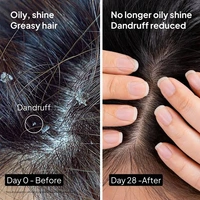 Scalp peel