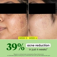 Dot & Key CICA Calming Skin Renewing Night Gel | for Sensitive & Acne-Prone Skin | Overnight Skin Repair | for Redness & Irritation | Fades Dark Spots With Niacinamide, Green Tea & Hyaluronic | 60ml