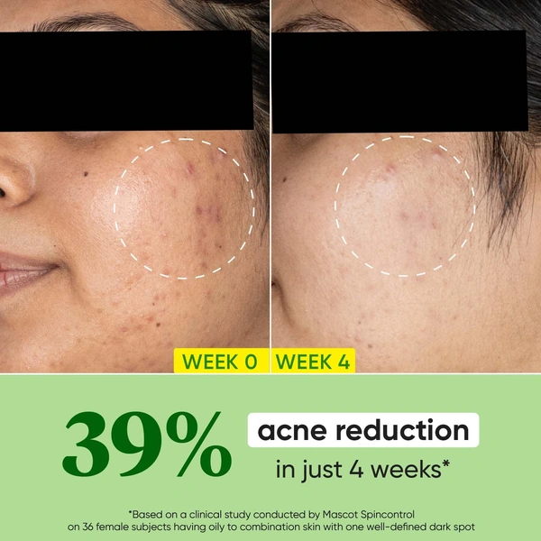 Dot & Key CICA Calming Skin Renewing Night Gel | for Sensitive & Acne-Prone Skin | Overnight Skin Repair | for Redness & Irritation | Fades Dark Spots With Niacinamide, Green Tea & Hyaluronic | 60ml
