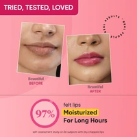 Dot & Key DOT & KEY Gloss Boss Cherry Lip Balm� 12g | With SPF 30 | Vitamin C + E Enriched | Lightweight & Non Sticky | Fades Lip Pigmentation | Glossy and Hydrating | Shea Butter Lip Balm