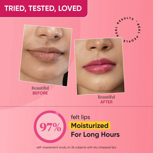 Dot & Key DOT & KEY Gloss Boss Cherry Lip Balm� 12g | With SPF 30 | Vitamin C + E Enriched | Lightweight & Non Sticky | Fades Lip Pigmentation | Glossy and Hydrating | Shea Butter Lip Balm