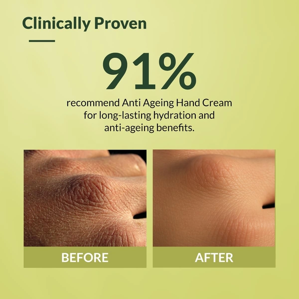 Fixderma Anti Ageing Hand Cream 30g | Ceramide & Hyaluronic Acid Hand Moisturizer | Smoothens Dry Rough Hands | Anti-Wrinkle Repair | Shea Butter Nourishment | Men & Women | All Skin Types