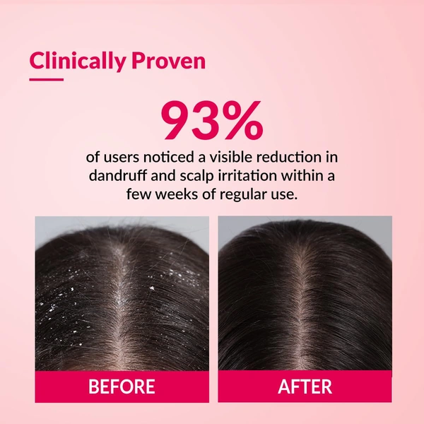 Fixderma Bioteez-S Anti Dandruff Shampoo 75ml | Controls Recurrent Dandruff, Reduces Flaky Scalp, Relieves Itchy & Dry Scalp | Nourishes Hair | Sulphate & Paraben Free