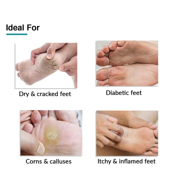 Fixderma Foobetik Cream | For Intensive foot Repair | For Dry & Cracked Feet | Soothe & Protect Diabetic Feet | Hydration for dry cracked feet | Non-greasy foot cream | Softens rough skin | Heel Repair | Paraben Free | 50g