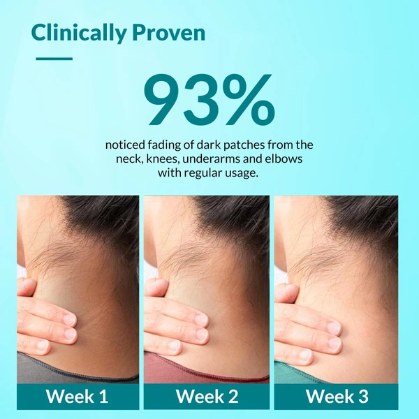 Fixderma Nigrifix Cream for Acanthosis Nigricans 50g | Exfoliating Cream with Lactic Acid & Retinol | Reduces Dark Thick Skin on Neck, Underarms, Knuckles, Elbows & More