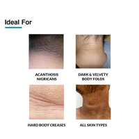 Fixderma Nigrifix Cream with retinol, Lactic Acid & Urea | For Skin Imperfection associated with Acanthosis Nigricans | For Body Parts like Neck, Ankles, Knuckles, Armpits & Elbows | For Dark & Dry Skin | Exfoliant Darkest Skin Gently | 100g