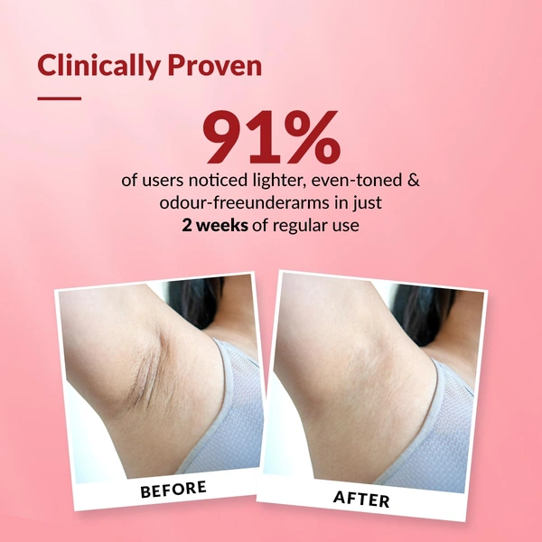 Fixderma Nigrifix Underarm Velvet Musk Roll On 60ml with 6% AHA, Lactic Acid, 1% Mandelic Acid & Kojic Acid | Brightens, Exfoliates & Smoothens Dark Underarms | Sensitive Skin Safe