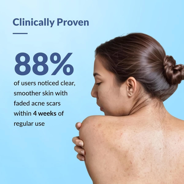 Fixderma Salyzap 2% Salicylic Acid Body Acne Spray For Men & Women 200ml | Targets Back, Shoulder, Neck & Chest Acne | Controls Breakouts, Clears Clogged Pores & Improves Texture