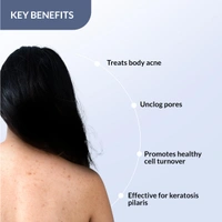 Fixderma Salyzap 2% Salicylic Acid Body Acne Spray For Men & Women 100ml | Targets Back, Shoulder, Neck & Chest Acne | Controls Breakouts, Clears Clogged Pores & Improves Texture