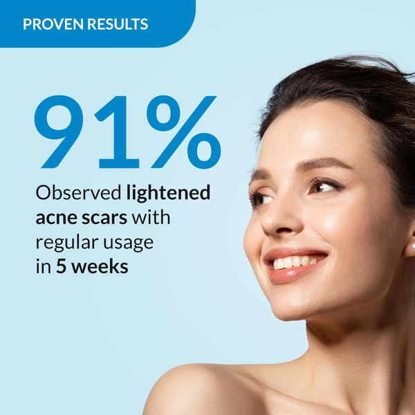 Fixderma Skarfix-TX Face Cleanser with Tranexamic Acid, Kojic Acid & Niacinamide | Advanced Pigmentation Face Wash | Brightens, Evens Skin Tone | Suitable for All Skin Types - 75gm