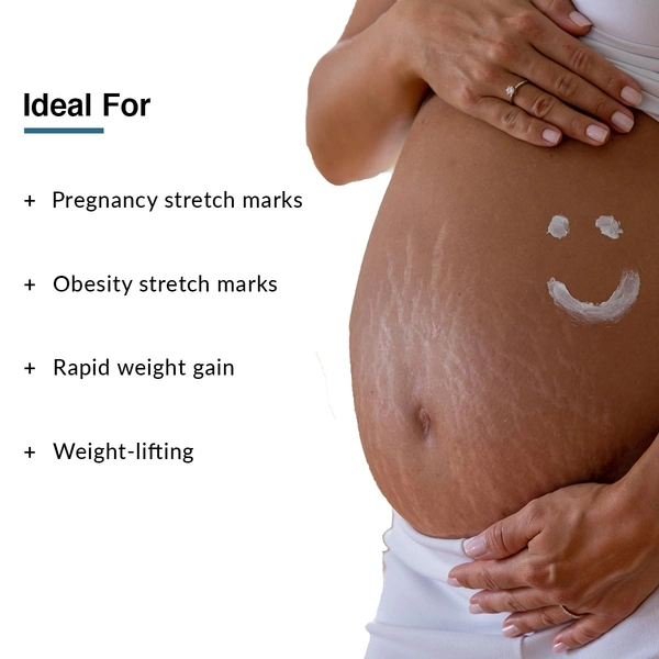 Fixderma Strallium Stretch Mark Cream | Fade and Prevent Stretch Marks | Stretch mark remover for Stomach, thighs & all body parts | Removes Pregnancy , Obesity , Weightlifting , Stretch Marks | 75g