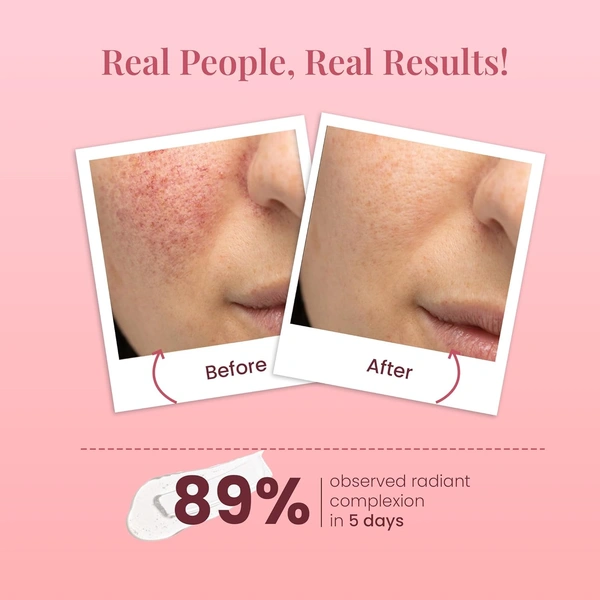 La Pink Natural La Pink Face Wash Ideal Bright White Haldi 100ml, Boosts Radiance | Reduces Pigmentation & Dark Spots | Hydrating & Soap-Free | Kakadu Plum, Mulberry & Cactus Flower | All Skin Types