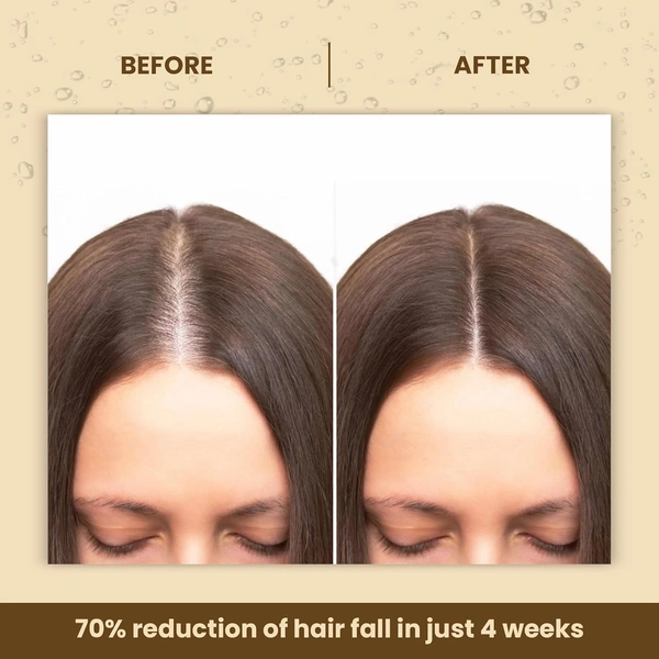 La Pink Natural La Pink Hair Oil Methi Dana 8-in-1 150ml | White Haldi, Bhringraj, Kadi Patta, Hibiscus & Onion | Microplastic-Free Formula |  Enhances Color Vibrancy & Controls Hair Fall