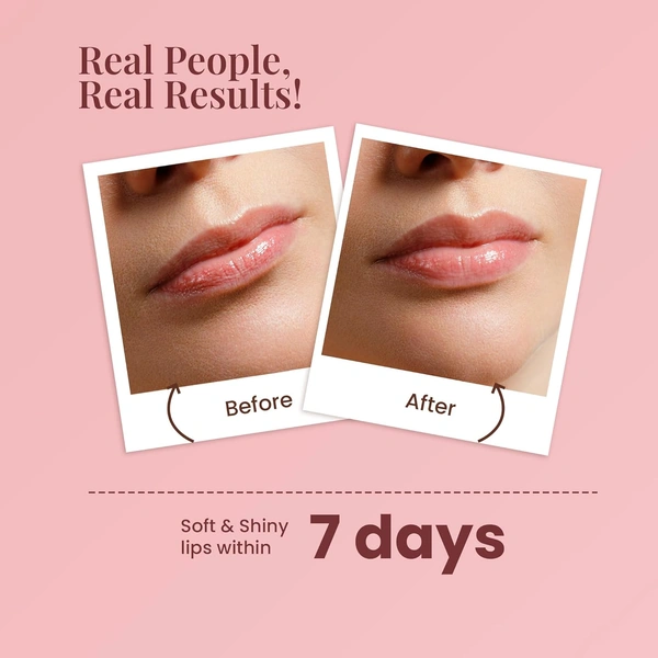 La Pink Natural La Pink Strawberry Tinted Lip Balm 15g with Shea & Kokum Butter | Deep Nourishment & Hydration | Soft & Smooth Lips | 100% Microplastic-Free| Shiny & Natural Tint