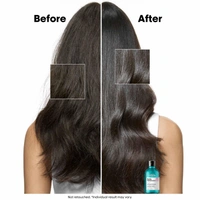 Loreal Professionnel Scalp Advanced Anti-Discomfort Shampoo 300ml |For Sensitive Scalp