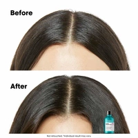 Loreal Professionnel Scalp Advanced Anti-Discomfort Shampoo 300ml |For Sensitive Scalp