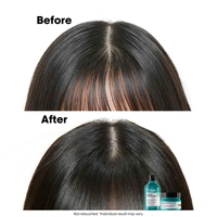 Loreal Professionnel Scalp Advanced Anti-Gras Oiliness Shampoo 300ml -With 4% AHA Purify Oily Scalp
