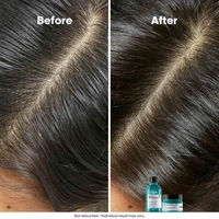 Loreal Professionnel Scalp Advanced Anti-Gras Oiliness Shampoo 300ml -With 4% AHA Purify Oily Scalp