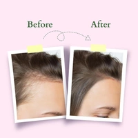 Lotus Organics+ Hair Growth Active Concentrate Serum 28ml | 100% Organic Rosemary Oil, AnaGain & Hairdian | Strengthens Hair Follicles & Boosts Growth | For All Hair Types