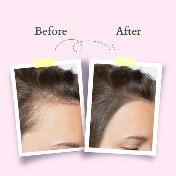 Lotus Organics+ Hair Growth Active Concentrate Serum 28ml | 100% Organic Rosemary Oil, AnaGain & Hairdian | Strengthens Hair Follicles & Boosts Growth | For All Hair Types
