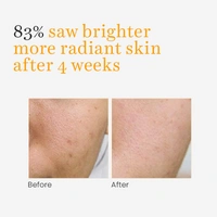 O3+ Professional O3+ Vitamin C Serum Glow 30ml