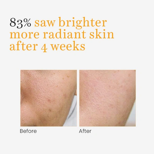 O3+ Professional O3+ Vitamin C Serum Glow 30ml
