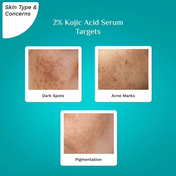 Pilgrim 2% Kojic Acid Serum - 30ml | with 1% Alpha Arbutin & Korean White Lotus | Reduces Dark Spots & Acne Marks | Anti-pigmentation Face Serum | Even Skin Tone | Radiant Complexion Serum | Hydrating brightening | For All Skin Types